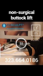 EMSCULPT Non-surgical Buttock Lift
