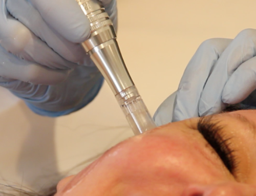 Microneedling Los Angeles, Dr. Michele Ware