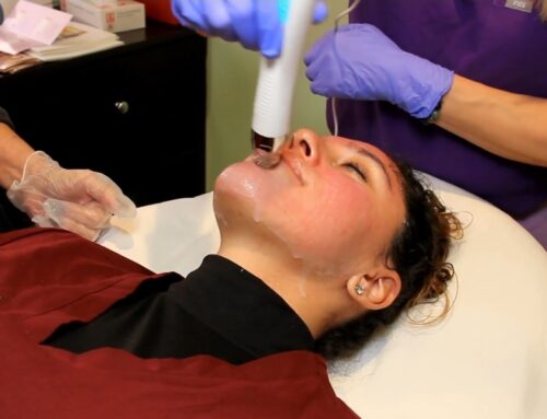 Microneedling, $500 per treatment, $1350 package of 3